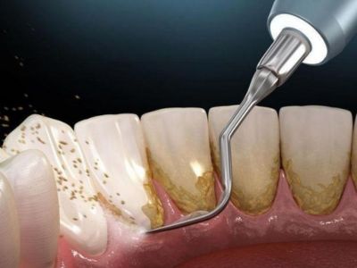 General dentistry